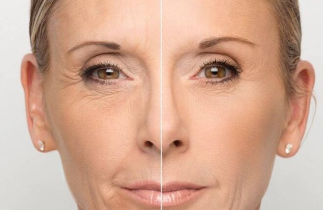 Gesichtshaut vor und nach der Verjüngung mit Masken.