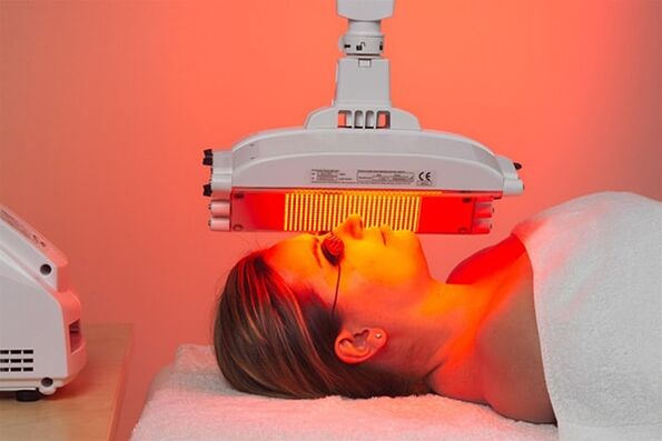 Hardware-Phototherapie-Methode zur Vorbeugung der ersten Zeichen der Hautalterung.